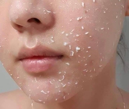 اسپری لایه بردارم روشن کننده اصل Dr.Melaxin Peel Shot Exfoliating Kojic Acid Turmeric Spray 200ml(ارسال به ضمانت اصل بودن)